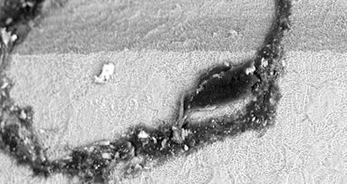 Is your dental implant system truly safe and clean?