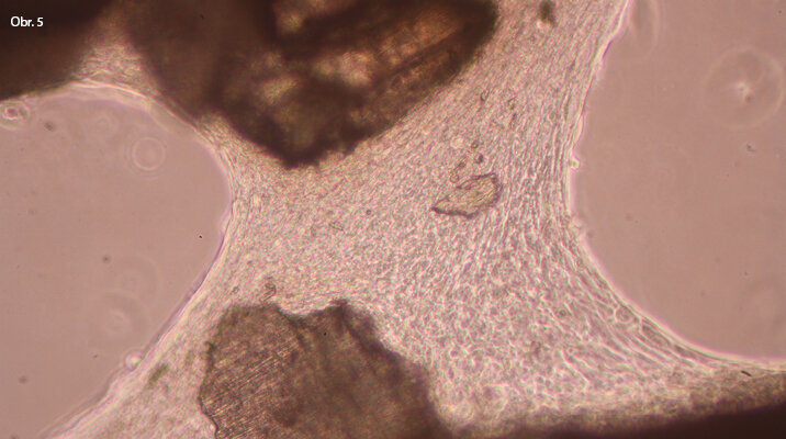 Mezi zrny tvrdé zubní tkáně se poměrně rychle (cca do 24 hodin) vytváří ucelený buněčný můstek, což může znamenat rychlou tkáňovou reakci