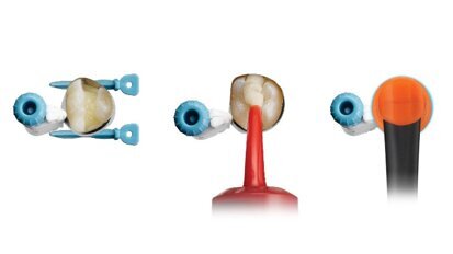 Dentsply Sirona lancia Surefil one: un nuovo composito rivoluzionario