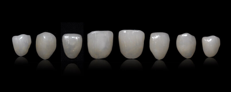 Fig. 21: Milled IPS Empress
CAD veneers.