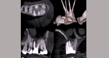 Odontología de hoy con criterios de ayer
