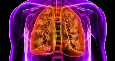 Des bactéries buccales liées au risque de pneumonie