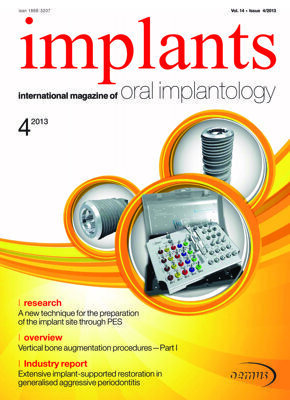 implants international No. 4, 2013 implants international No. 4, 2013