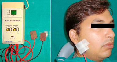 Una terapia a base di elettricità può alleviare la secchezza del cavo orale