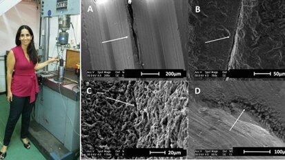 Novo estudo sugere que muitos implantes dentários podem ser propensos à fratura