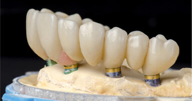 Straumann Campus broadcasts three online webinars on current implant treatments