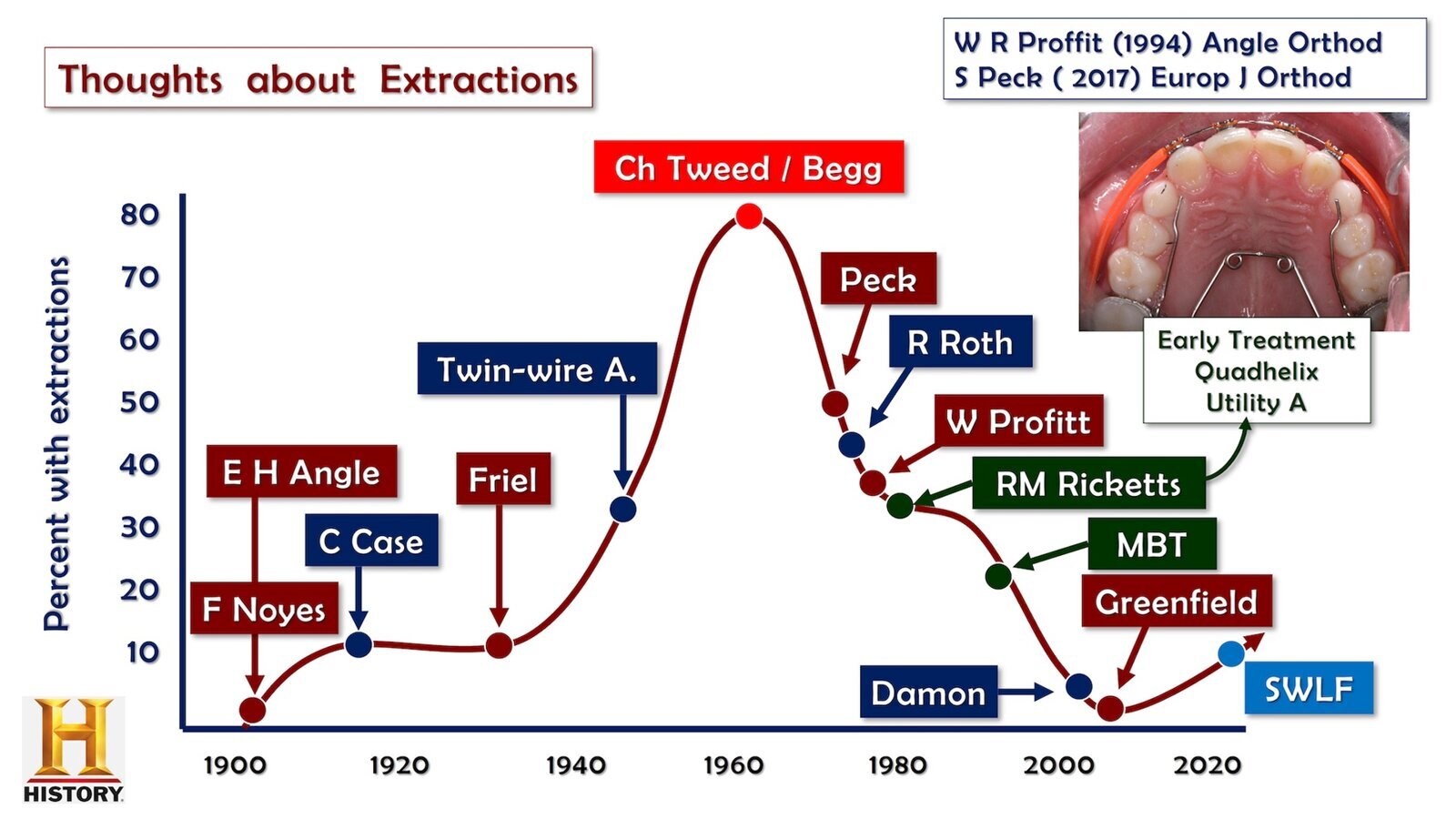 ¿Extracción o Expansión en Ortodoncia? (3)