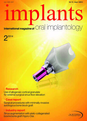 implants international No. 2, 2014 implants international No. 2, 2014