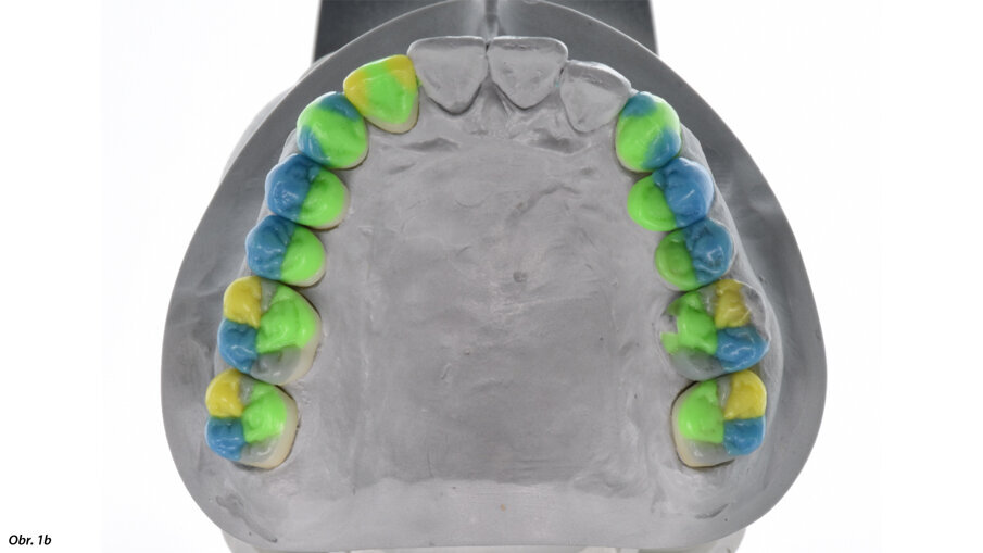Sekvenční funkční okluze od prof. Rudolfa Slavicka.