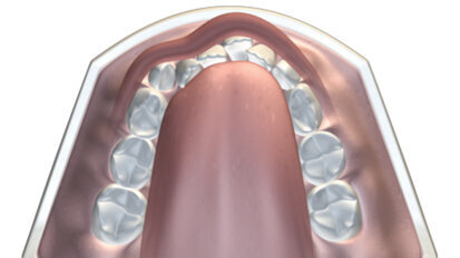 Myofunctional orthodontics and myofunctional therapy Myofunctional orthodontics and myofunctional therapy