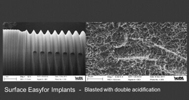 Valutazione a 12 mesi  degli impianti Easyfor cilindrici secondo i criteri di successo/insuccesso descritti in letteratura. Studio prospettico multicentrico. Analisi su 50 casi