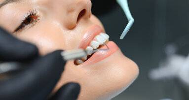 MiCD Fiber Filling: 4R protocol and applications