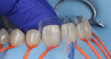 Optimizing aesthetic outcomes with Haji’s  matrix technique