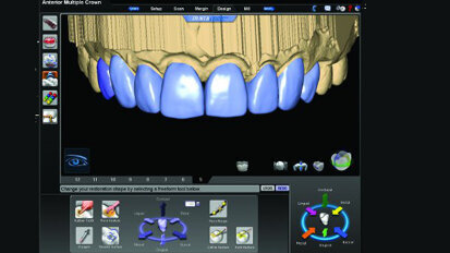 CAD/CAM dentistry and the laboratory technician: Partners in success
