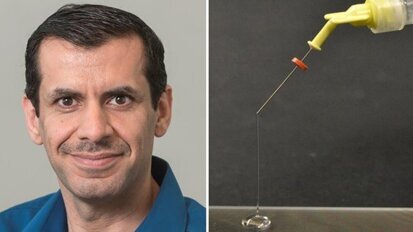 Neues antimikrobielles Gel für Wurzelkanalbehandlungen entwickelt Neues antimikrobielles Gel für Wurzelkanalbehandlungen entwickelt