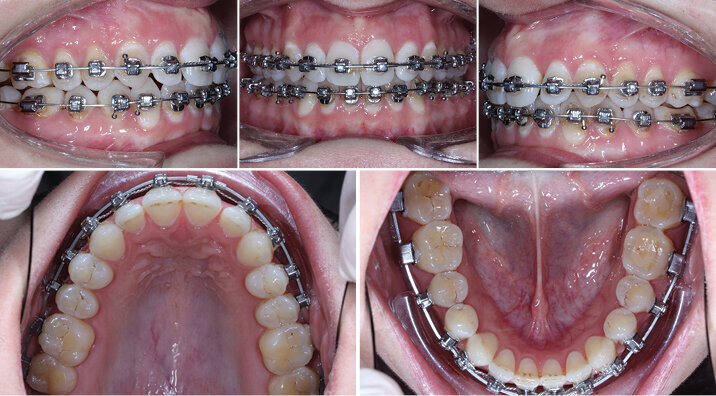 7. návštěva – 57 týdnů