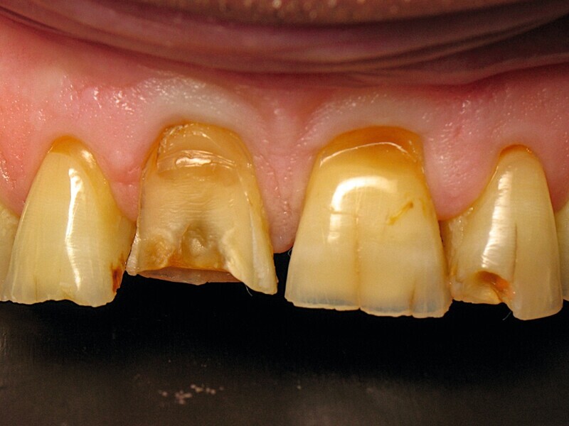 Fig. 12 : Vue rapprochée de la situation initiale