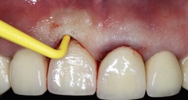 Importante Curso sobre Medicina Periimplantar