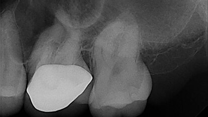 EdgeFile X7: Beastly bifurcation