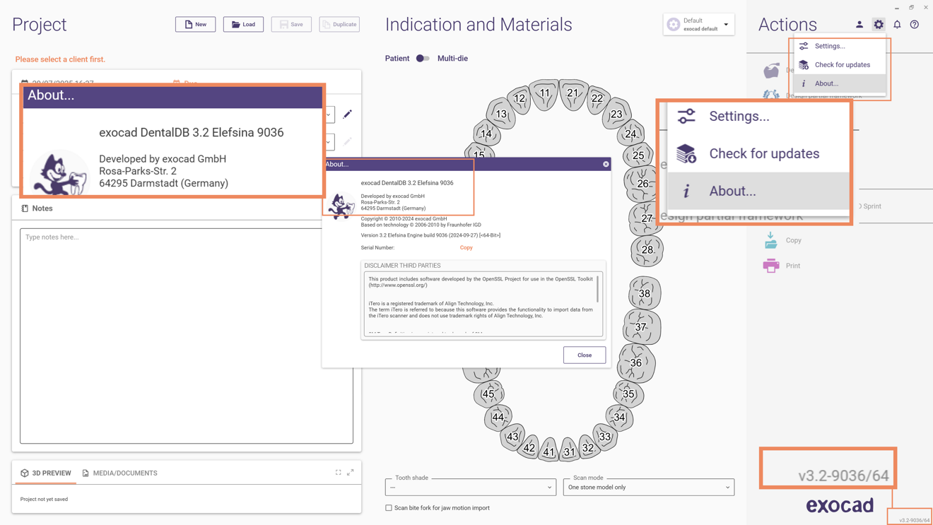 Fig. 1: The engine build is displayed in the About section and in the lower-right corner of the exocad screen.