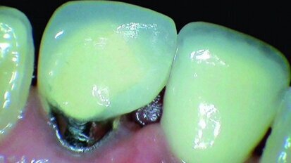 La CFAO au fauteuil est un ajustage naturel pour une pratique des technologies « vertes »