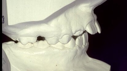 Die weitreichende Bedeutung der kieferorthopädischen Behandlung