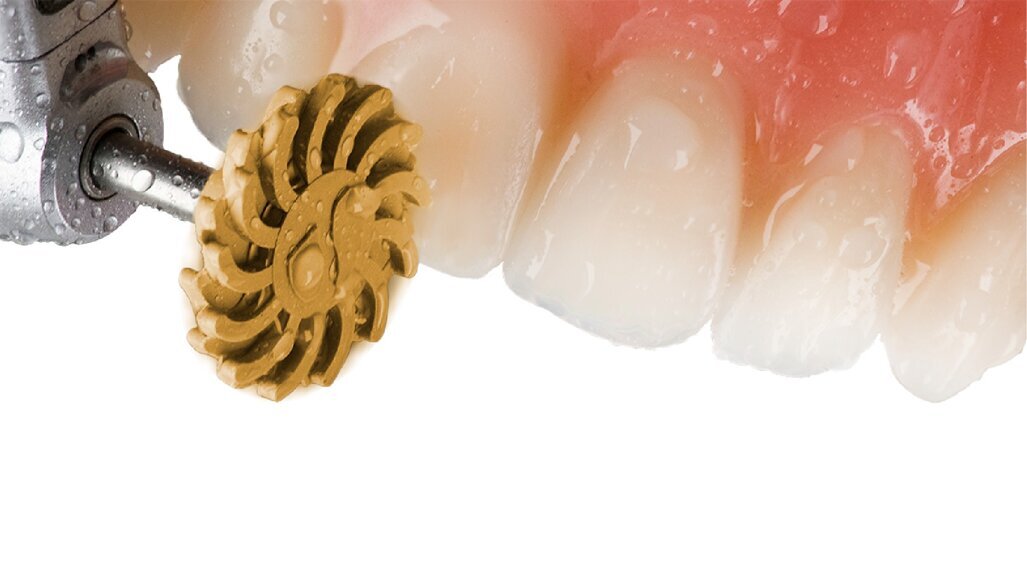 Enhance Flex: la nuova frontiera della finitura e lucidatura dei restauri in composito