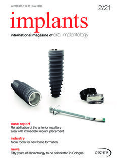 implants international No. 2, 2021 implants international No. 2, 2021