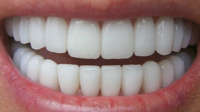 Οι κλασικές μέθοδοι απεικόνισης δεν θα εξαλειφθούν με την ΥΤΚΔ