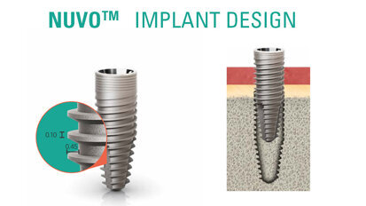 Tapered Implants: Designing original to boost primer stability