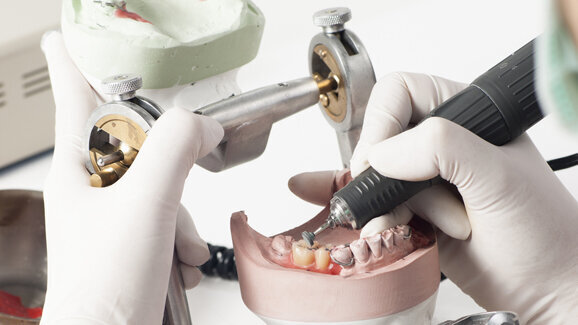 Zahntechniker: Leichte Verbesserung der Geschäftslage