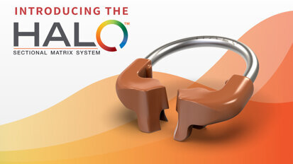 Clinical Q&A: The Halo Matrix System
