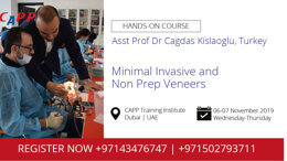 Minimal Invasive and Non Prep Veneers Smart Smile Design with Veneers