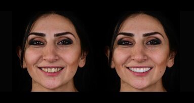 Study shows DTS PRO results are very good to excellent