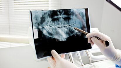 Developmental dental anomalies in offspring linked to consanguineous marriages, study finds