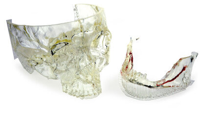 3D printeri u stomatologiji i zubnoj tehnici danas