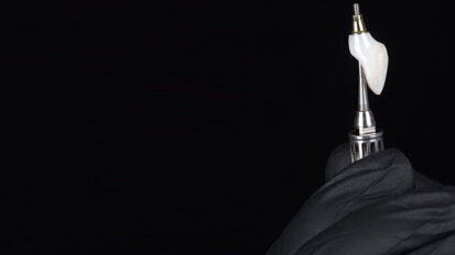 Minimally invasive implant therapy in the anterior zone