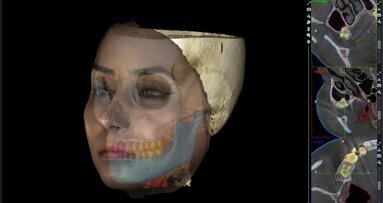 Applicazioni dell’intelligenza artificiale in Ortodonzia