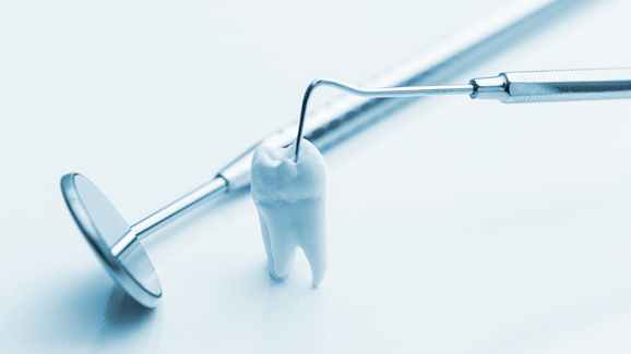 Amalgam doch das stabilere Füllungsmaterial?