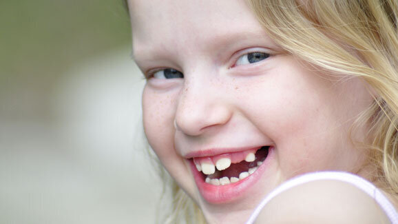 Zahnverlust ist immer behandlungsbedürftig