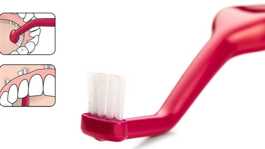 TePe Implant Care™ Il giusto strumento per una completa terapia implantare studiato su richiesta della professione dentale