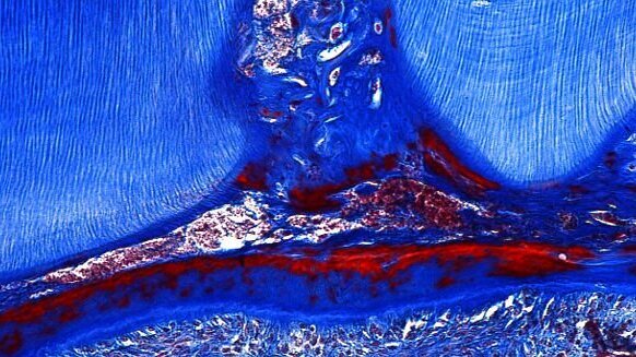 Regénération des dents grâce à une médicament contre Alzheimer