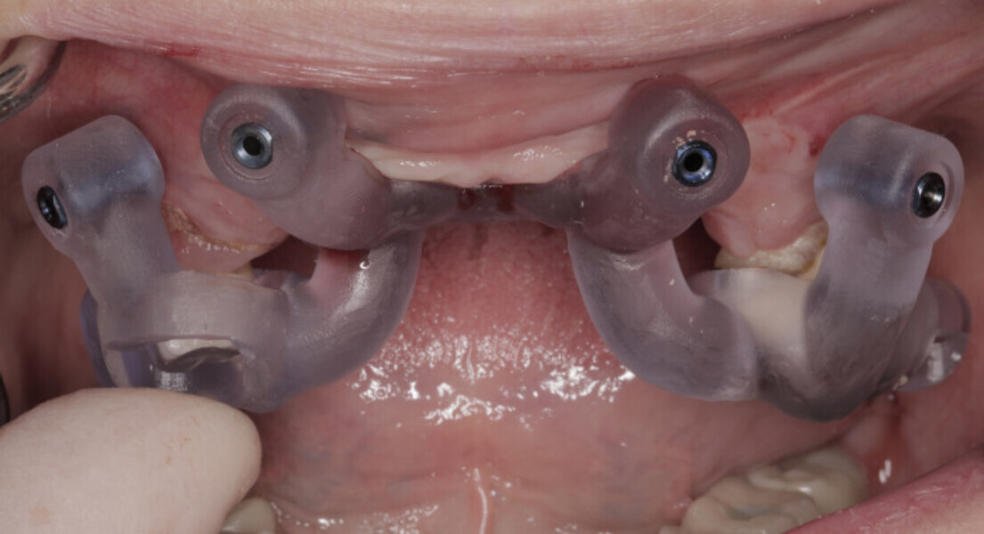 Fig. 8b: and in situ.