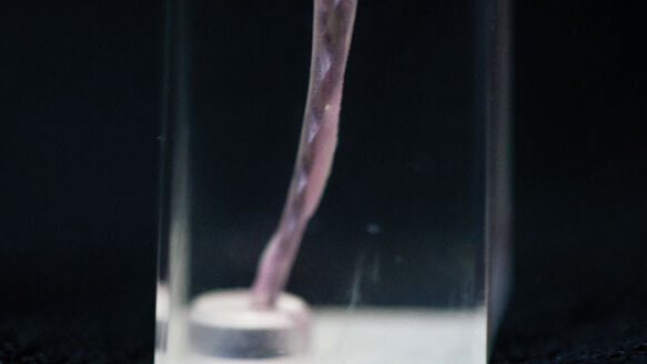 Passive micro-volume management of sodium hypochlorite in endodontic treatment