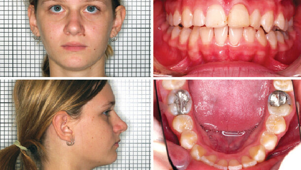 Zahráváme si s pravdou? Aneb co víme o etiologii ortodontických anomálií