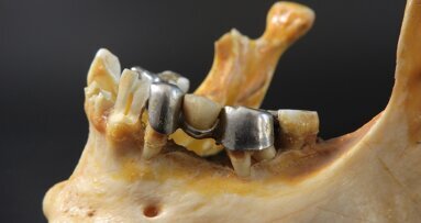 Nowy materiał pomoże w leczeniu zakażeń kości