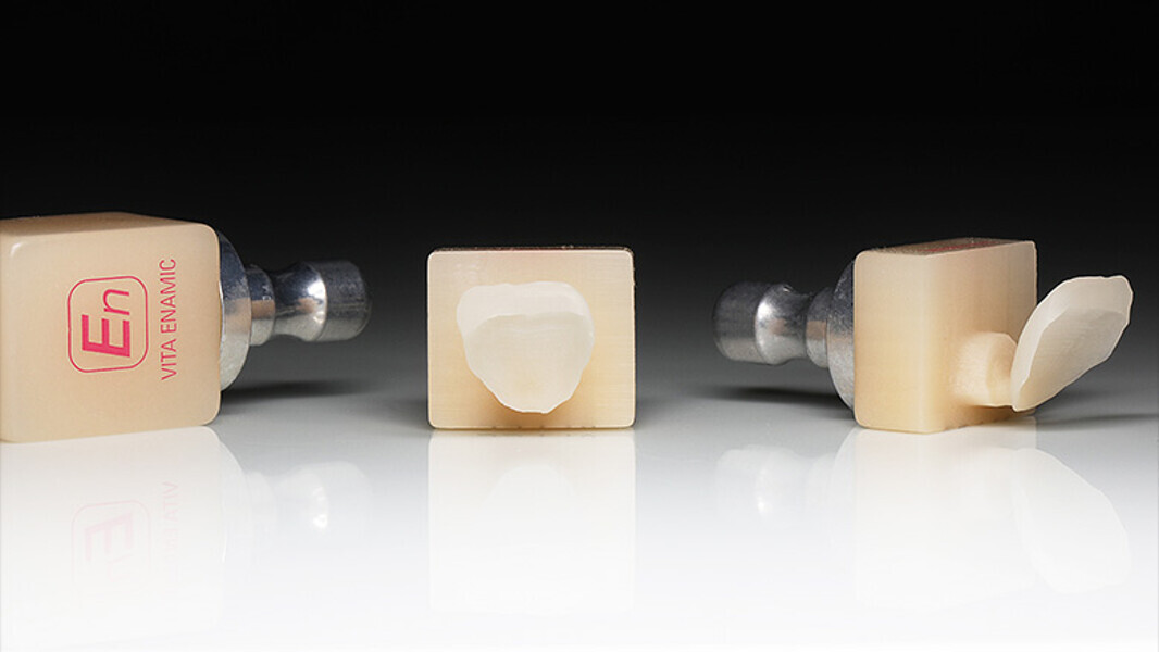 Fig. 9. Las carillas de VITA ENAMIC multiColor muy delgadas, inmediatamente después del fresado.