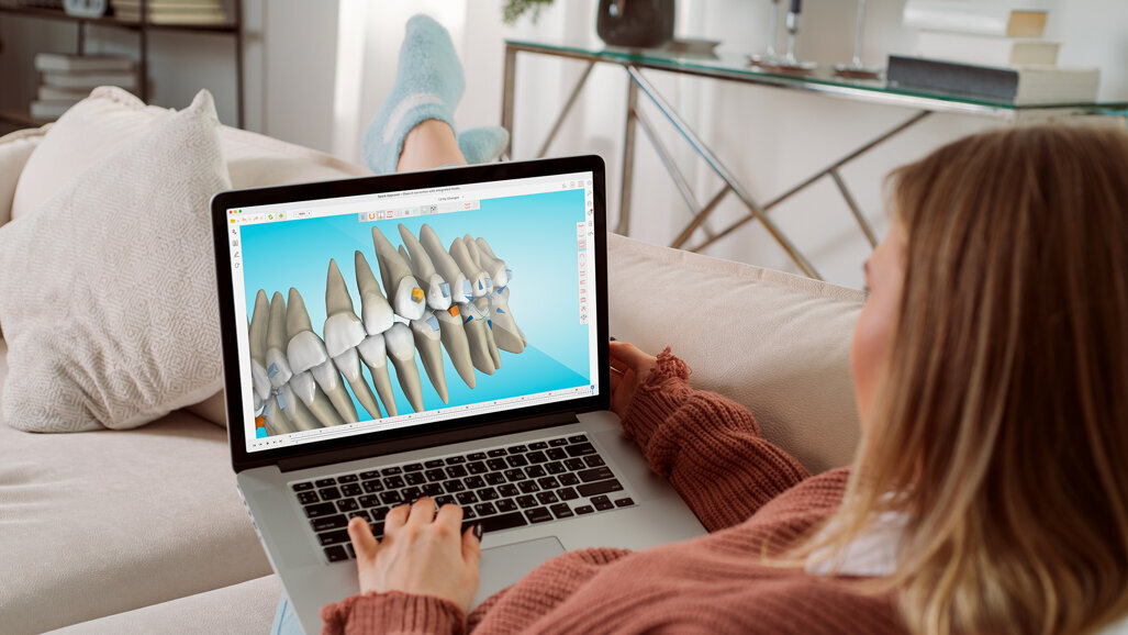 Spark Clear Aligners announces key clinical updates and doctor-driven innovations in Release 14