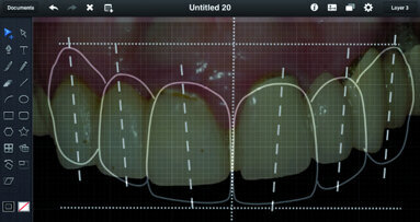 ADF 2015 : Utiliser l’iPad au cabinet dentaire