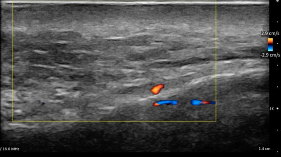 La rilevazione ecografica nella programmazione, nell’esecuzione e nel follow up dei piani terapeutici di medicina estetica del volto